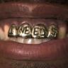 iNeed$